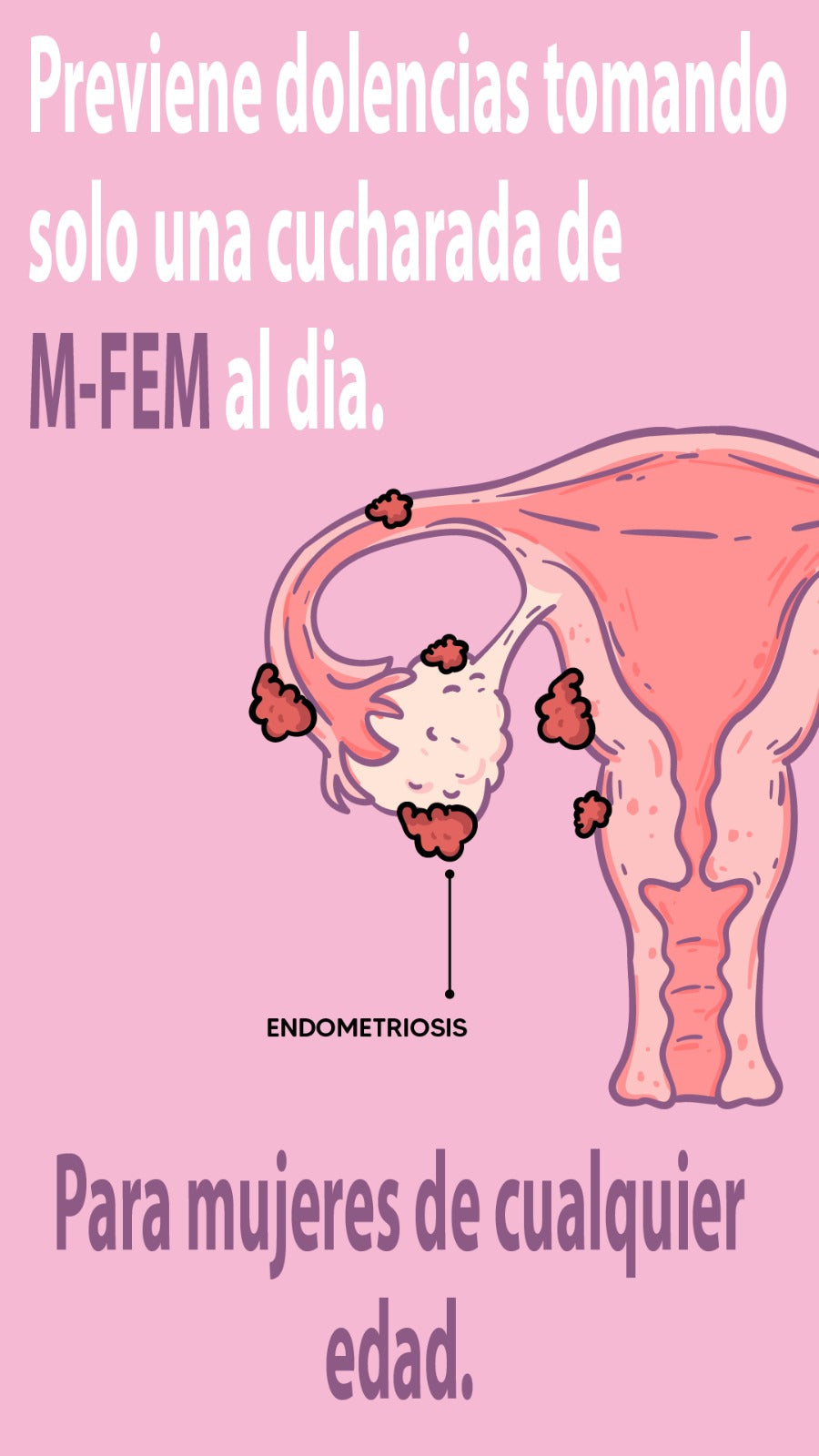 M-FEM