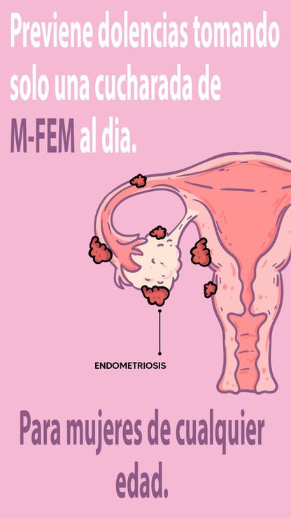 M-FEM